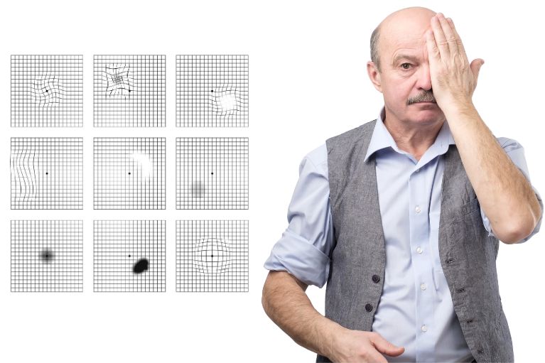 Zniekształcenia metamorfopsje Test Amslera